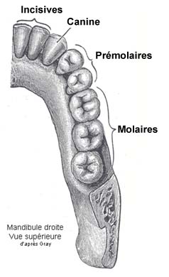 dents